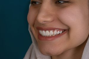 dental implants utah